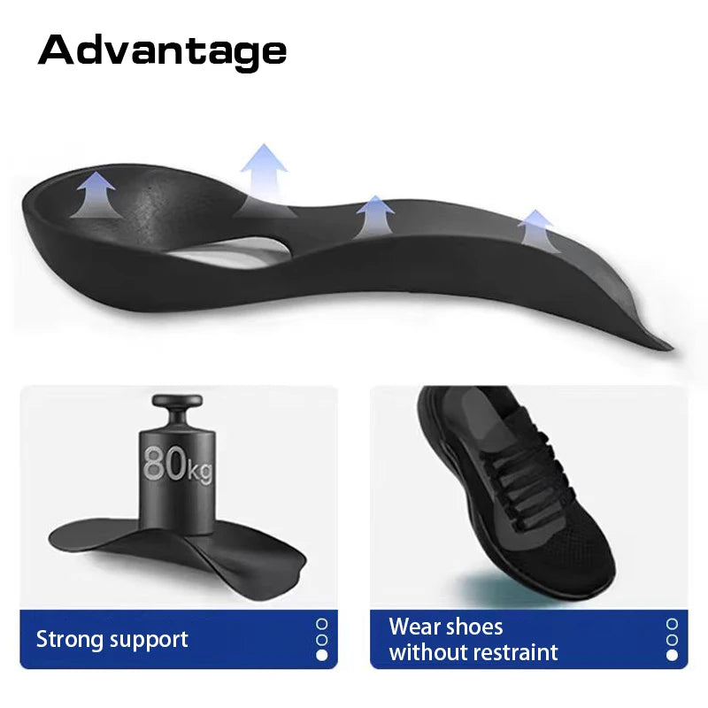 Flat Foot O-Shaped Leg Insoles for Shoes Arch Support alternate view