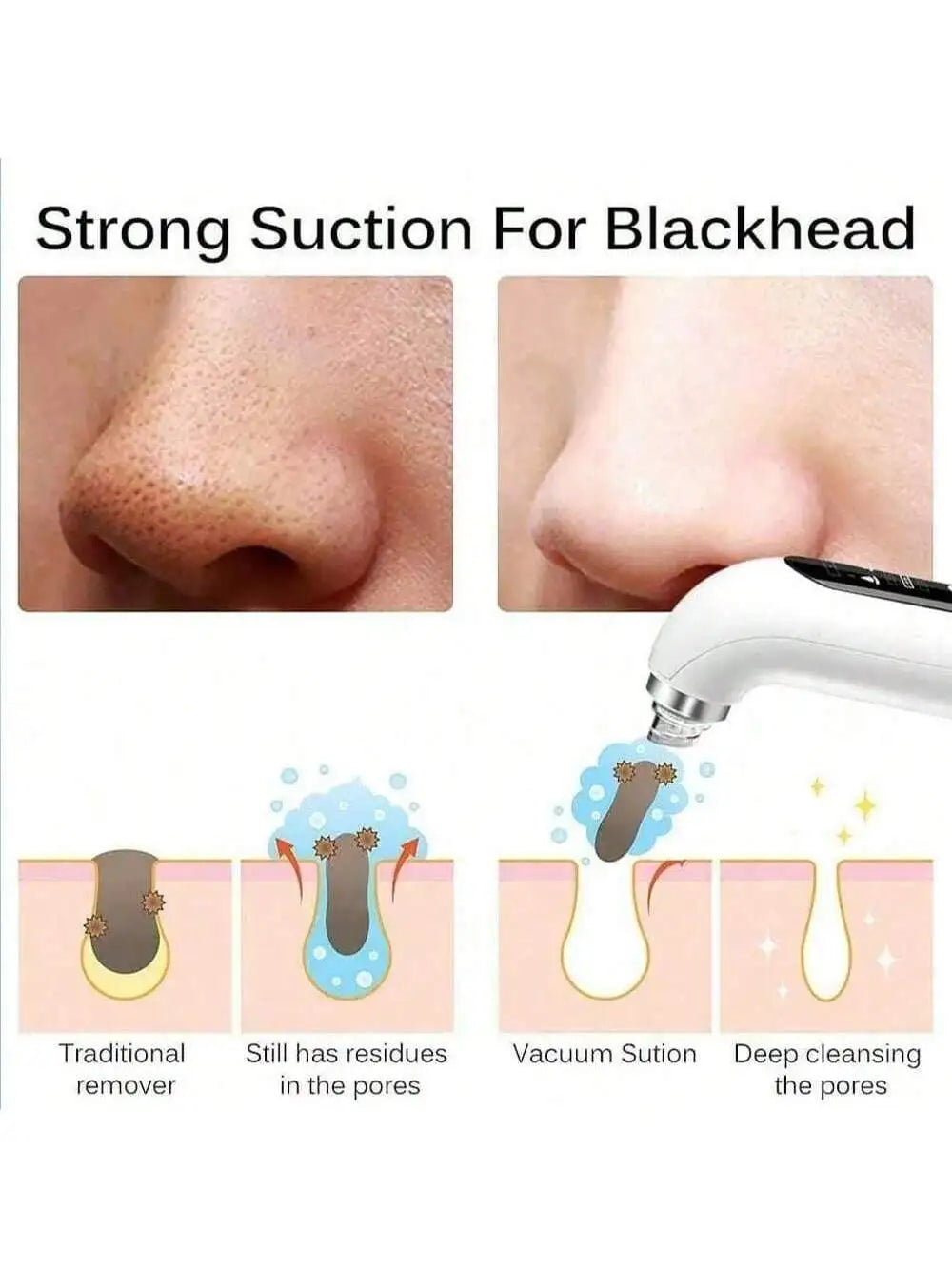Pore Vacuum Blackhead Remover Women and Men Facial Cleaning Beauty Equipment Facial P alternate view