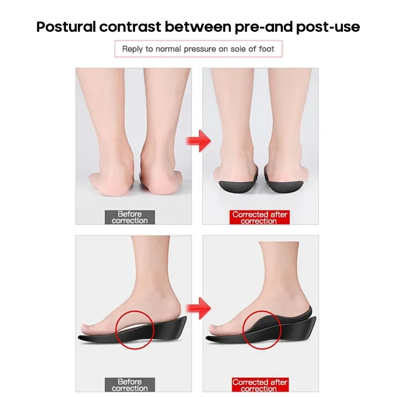 Flat Foot O-Shaped Leg Insoles for Shoes Arch Support additional angle