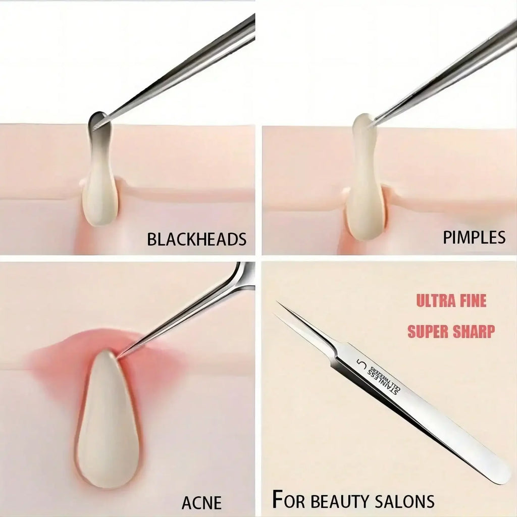 Ultra Fine Needle Tweezers for Facial Pore Cleaning Blackhead Acne Removal Skin Care alternate view
